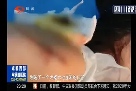 江西：停车场起落杆划伤小孩 该谁负责？图片
