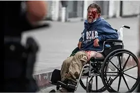 触目惊心！美国流浪汉遭警方橡皮子弹击中，满脸是血图片