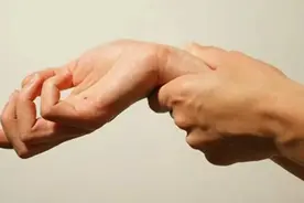 经常手麻脚麻，也许是身体在提醒你，被这几种病“缠上”了图片