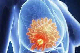 乳腺癌威胁女性健康，肿瘤之下研究如何？图片