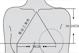 如何解决隆胸术后乳房不对称难题图片