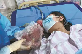 惊心动魄！河池一女子怀双胞胎一胎流产，另一胎延迟24天出生图片