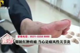 「科普答疑」警惕！脚趾红肿疼痛 当心是痛风性关节炎！视频封面