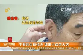 大连：大爷耳朵上长了个瘊子，不去医院反而用偏方，差点出大事儿