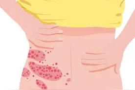 “缠腰龙”疫苗优惠500元！两针总价普遍超4400元图片