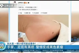一颗小痣可能会要命！手掌、足底有黑痣？警惕变成黑色素瘤！视频封面