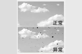 看一组对比图 能自查4种眼病图片