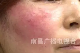 南昌女子花9000元美容！结果让她后悔不已……图片