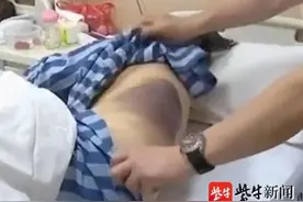 75岁老太学别人“撞树养生”缓解腰痛，结果却吓人图片