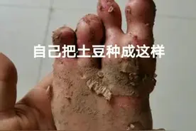 洋芋成精了？腾冲村民家的洋芋长出“脚趾头”图片
