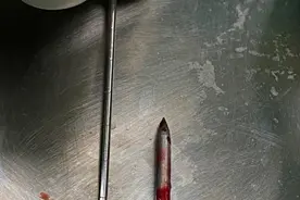 钢钉经下颌射入装修工大脑 广州医生开颅“拔钉”图片