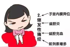 痛经，难言之痛？妇科医生一次性帮你解答图片