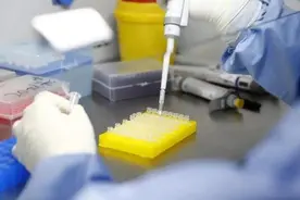 核酸检测阳性不一定是确诊病例？抗体检测可作重要补充图片