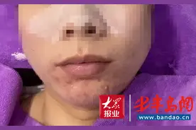 花了5000元做祛痘没效果室内还脏乱差？蕾特恩：顾客吃霸王餐图片