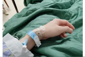 扛不住了！365天直播389场，李佳琦停播一周动手术图片