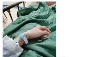 618高强度直播后，李佳琦动手术！网友的反应很真实图片