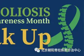 我怎么长了一身奶牛斑？图片