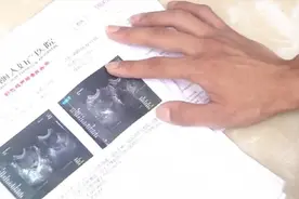 女子做人流麻醉50分钟后终止手术后续：第二次手术再次失败图片