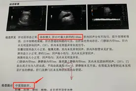 11岁男孩得重度肝硬化！家长蒙了：从小的“健康”习惯竟害了他图片