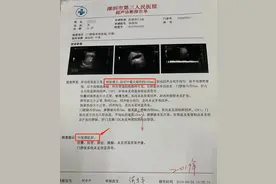 11岁男童得重度肝硬化！家长懵了：从小的“健康”习惯竟害了他图片