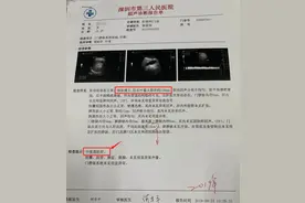 11岁娃130斤，竟是重度肝硬化！身体这些“求救”信号要警惕……图片