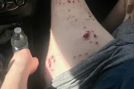 美国男孩被鲨鱼咬住尖叫 父亲却以为儿子是过于兴奋图片