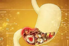 胃不好的人，6种食物医生劝你少吃！这些才是真正的养胃法图片