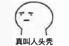 “为了长点头发，我真的很不容易！”女子花4.2万植发，效果却让她崩溃了图片