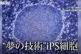 通过iPS细胞治疗视网膜色素变性 日本批准细胞膜片移植临床项目图片