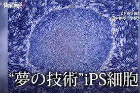通过iPS细胞治疗视网膜色素变性 日本批准细胞膜片移植临床项目图片