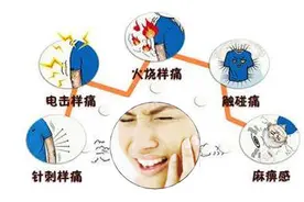 头面部刀割、电击般剧痛 提防老年群体高发的三叉神经痛图片