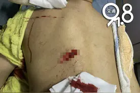 现实版农夫与蛇！杭州男子帮姐夫介绍工作，还给了3000块钱，结果却被他砍了两刀图片