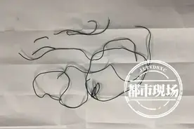 10岁男孩膀胱内取出1.5米长电线......咋进去的？医生都惊呆了图片