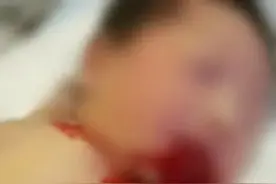 惊！宁波一出生1天多的宝宝突然口喷鲜血…图片