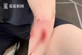 画面触目惊心！杜宾犬突然发狂连咬3人 主人也不放过图片
