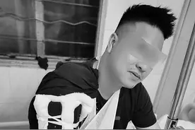酒后掰手腕“咔嚓”一声掰断手图片