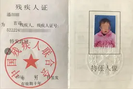 生日前夕全身被火烧！13岁女孩生日当天病床上痛哭度过图片