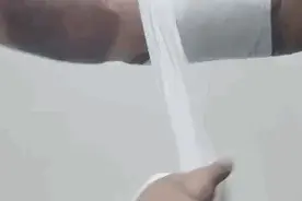 港警小虎Sir解下纱布，这一幕太心疼......图片