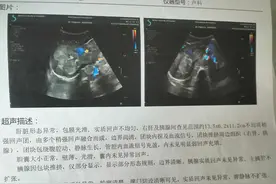 4岁病儿在北京与癌症战斗，护士妈妈在成都ICU救人图片