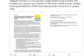 “食脑虫”入侵美国，能从鼻腔进入大脑，美145例感染病例仅4人幸存图片