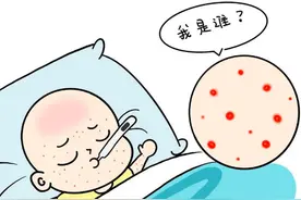夏季宝宝脖子大片红？间擦疹了解一下图片