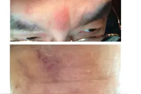 “缠腰龙”疫苗正式上市，北京广州7月中旬可接种，深圳7月下旬图片