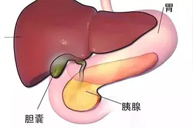 胆囊切除术后需要注意哪些？图片