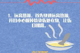 意外烫伤怎么办？图片
