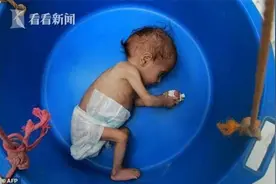 也门物资紧缺再临饥荒 数百万家庭或“撑不下去”图片