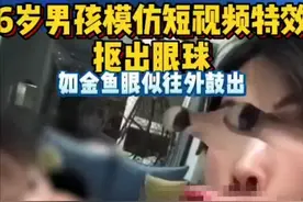 太可怕！模仿视频特效，浙江6岁男孩把自己眼球抠坏了图片
