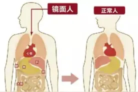 30分钟，完成“镜面人”无痛胃肠镜检查图片