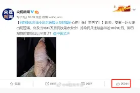 抗洪抢险人员的脚泡到起皱发白 网友：看着太心疼图片