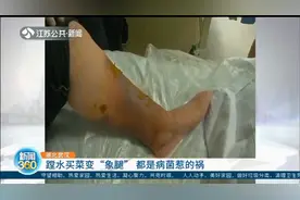 小心！武汉：老人蹚水买菜变“大象腿”，都是病菌惹的祸视频封面