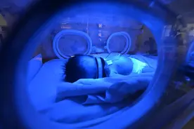 新生儿出生第二天出现黄疸，治疗两天后被家长带回家“晒太阳”，最后全身换血才转危为安图片